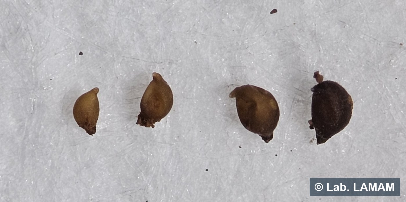 Cistos de diferentes tamanhos e cores — laboratório LAMAM