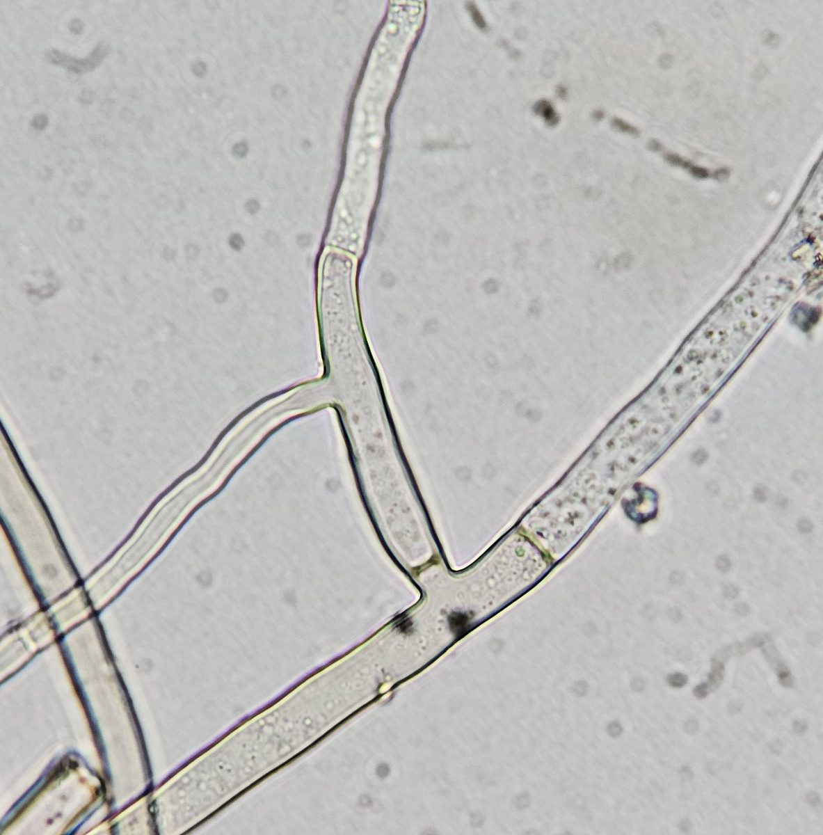 Hifas hialinas septadas