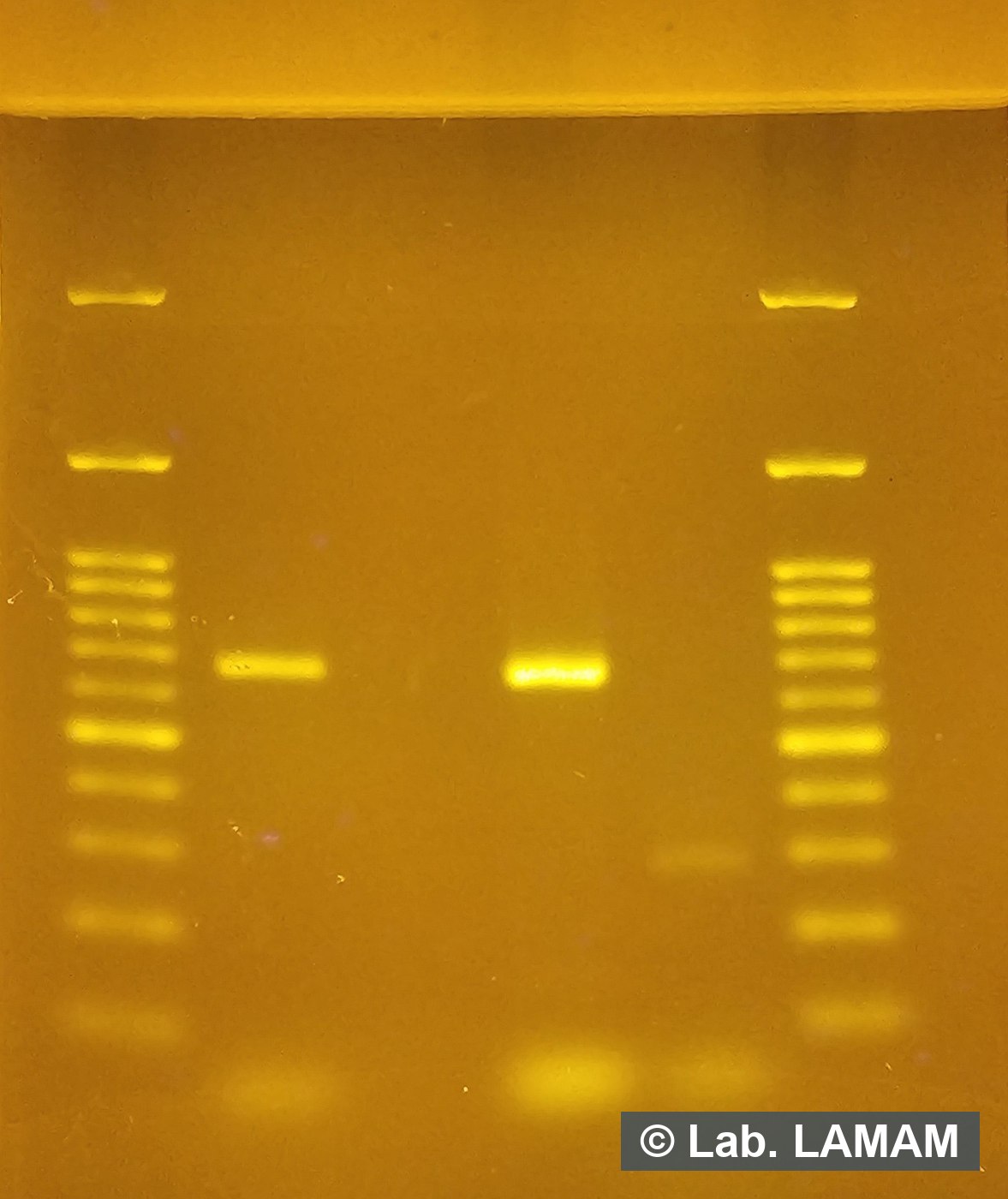 Gel de eletroforese com as bandas amplificadas e o marcador de peso molecular