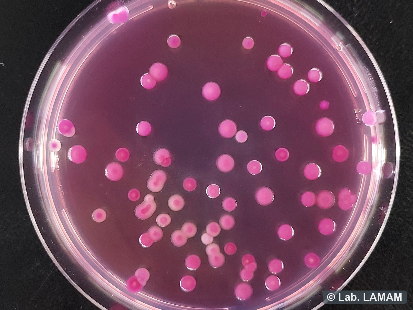 Placa com colônias de microrganismos contaminantes em meio de cultura